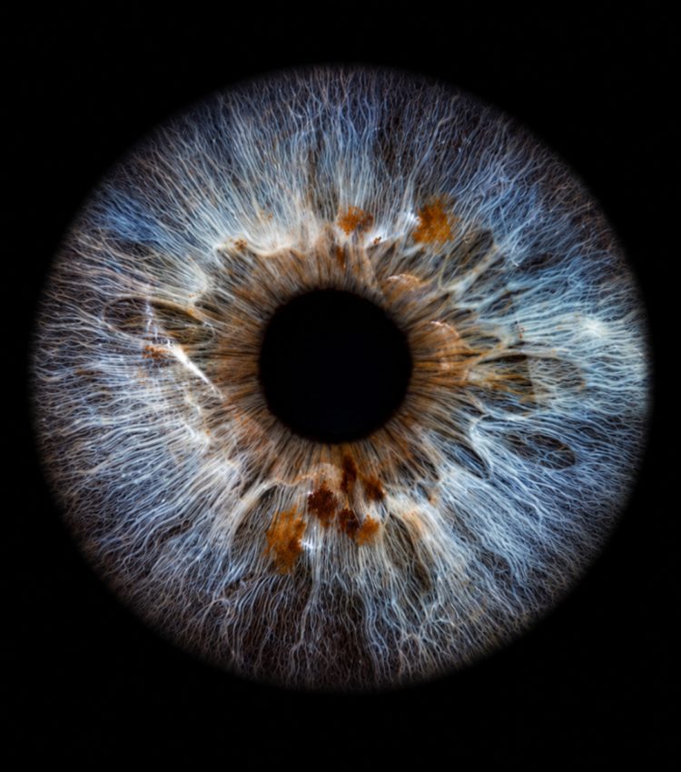 Iridologie - Observation de l'iris dans le cadre d'une consultation de naturopathie